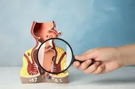 હરસ, મસા, ભગંદર — હરિકૃષ્ણ ક્લિનિક સુરત